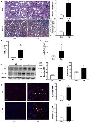 circHIPK3 Exacerbates Folic Acid-Induced Renal Tubulointerstitial Fibrosis by Sponging miR-30a